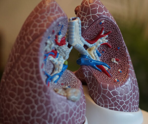 lungs-respiratory-breathing-therapy